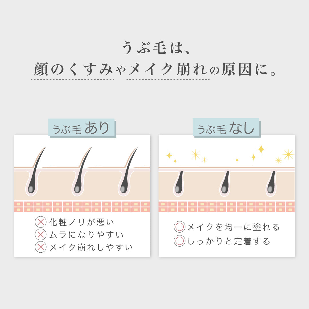 フェイスシェーバー